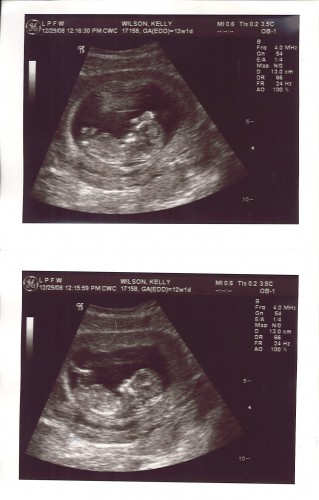 Lima Bean at 12 weeks